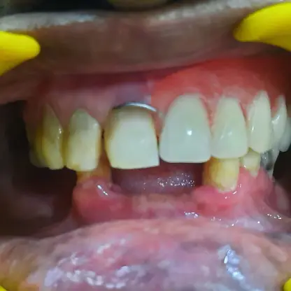 Cosmetic Dentistry in RS Puram,Coimbatore