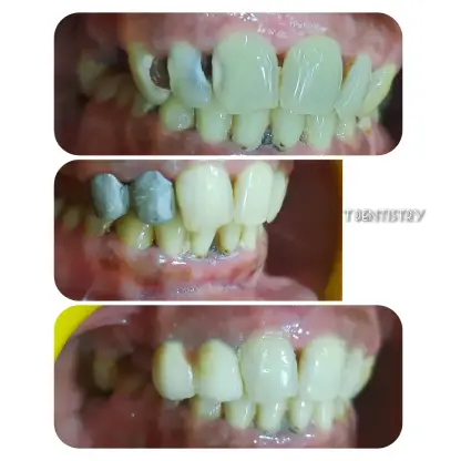 Dentist in RS Puram,Coimbatore