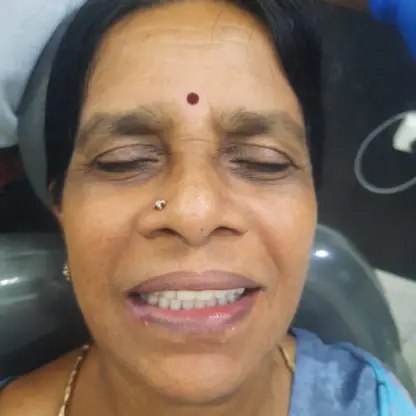 Cosmetic Dentistry in RS Puram,Coimbatore