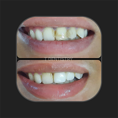 Dentist in RS Puram,Coimbatore