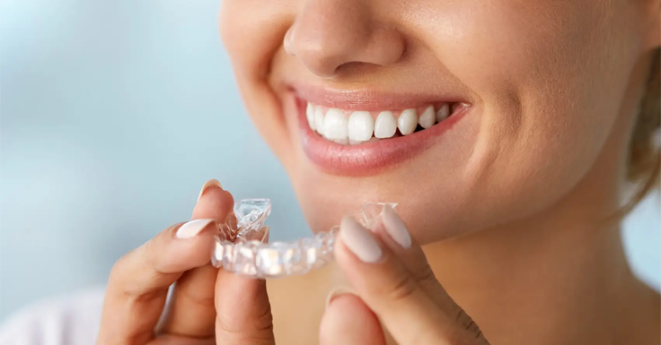 Invisalign Treatment in RS Puram,Coimbatore