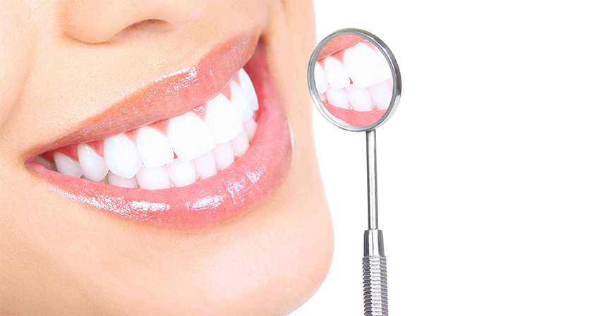 Teeth Whitening in RS Puram,Coimbatore